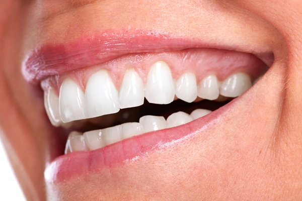 Restore Your Smile With Dental Veneers