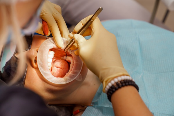 How To Reduce The Risk Of Dry Socket After A Tooth Extraction